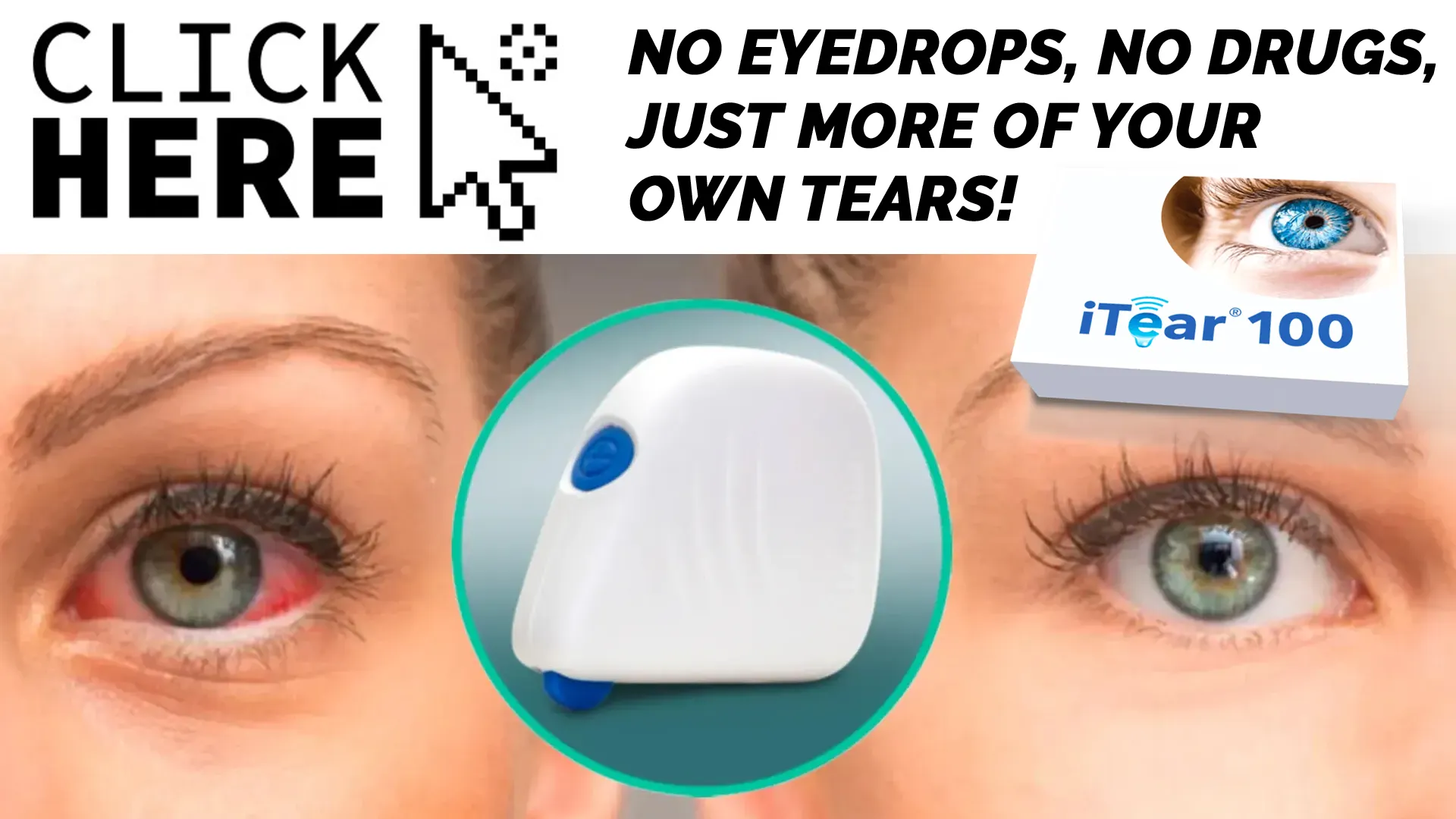 Embracing Natural Tear Production with iTear100